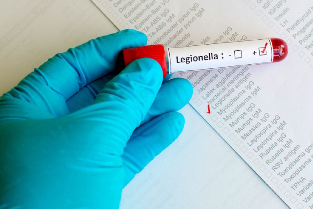 Legionella