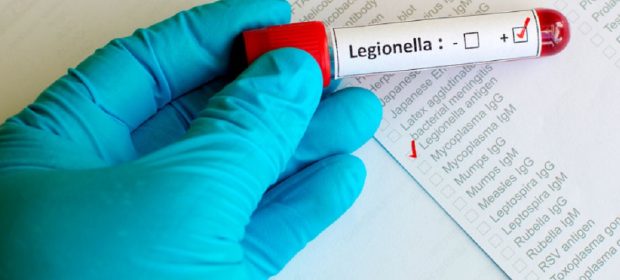 Legionella