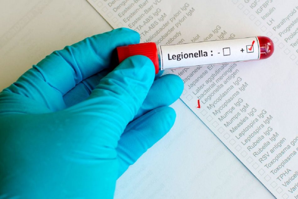 Legionella