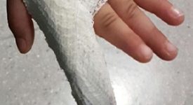 Gambiano spezza un dito a un agente in via Napo Torriani