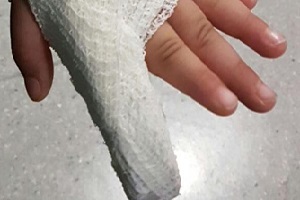 Gambiano spezza un dito a un agente in via Napo Torriani