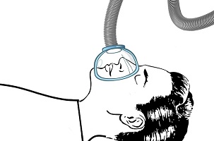 anesthesia respiratori