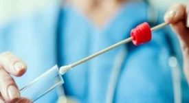 I dati di oggi: i tamponi effettuati: 49.484 (di cui 31.646 molecolari e 17.838 antigenici) totale complessivo: 10.017.648 i nuovi casi positivi: 1.396 (di cui 79 ‘debolmente positivi’) i guariti/dimessi totale complessivo: 749.551 (+1.710), di cui 3.014 dimessi e 746.537 guariti in terapia intensiva: 417 (-31) i ricoverati non in terapia intensiva: 2.351 (-90) i decessi, totale complessivo: 33.284 (+13) I nuovi casi per provincia: Milano: 431 di cui 166 a Milano città; Bergamo: 127; Brescia: 161; Como: 122; Cremona: 47; Lecco: 46; Lodi: 15; Mantova: 45; Monza e Brianza: 129; Pavia: 66; Sondrio: 36; Varese: 128. Covid: 1.625 casi e 55 decessi Covid: calano ricoveri e tasso positività Covid: 2335 nuovi casi e 144 vittime Coronavirus: 2.413 positivi rapporto al 9,2% Coronavirus: diminuiscono i ricoverati stabile al 12,2% il rapporto tamponi/positivi Coronavirus: il rapporto tamponi/positivi scende al 15,7% Covid: 129 vittime, rapporto al 23,2% Covid: percentuale tamponi positivi crolla dal 24,9 al 16,5% Covid: 8.822 positivi e 139 decessi Coronavirus: rapporto tamponi/positivi al 21.9% Coronavirus: 7.558 positivi e 47 decessi Covid: 51 morti e 4.956 positivi Coronavirus: 198 nuovi contagi e 3 decessi Più di 16.000 tamponi rivelano 269 positivi, 283 rientravano dall'estero e ben 215 hanno meno di 50 anni Tamponi a chi rientra da Spagna, Grecia, Croazia e Malta In Lombardia 23mila tamponi al giorno