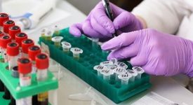 test diasorin sanità
