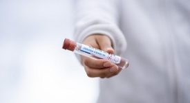 Covid: tasso di positività all'1.4% Covid: tasso di positività scende al 2.3% Covid: il tasso di positività scende al 3,4% Covid19, Città metropolitana: "Vaccinati oltre 5mila over 80 non autonomi"