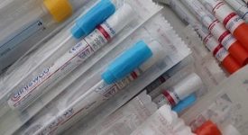 Carano, Sindaco di Assago: "Nella Farmacia Comunale anche per i non prenotati è erogato il servizio tamponi"