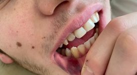 Figlio di un esponente di FdI aggredito e rapinato in Brera
