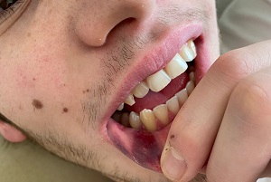 Figlio di un esponente di FdI aggredito e rapinato in Brera